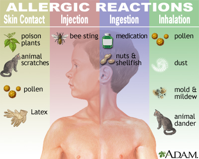 Food Allergies & Nutrition